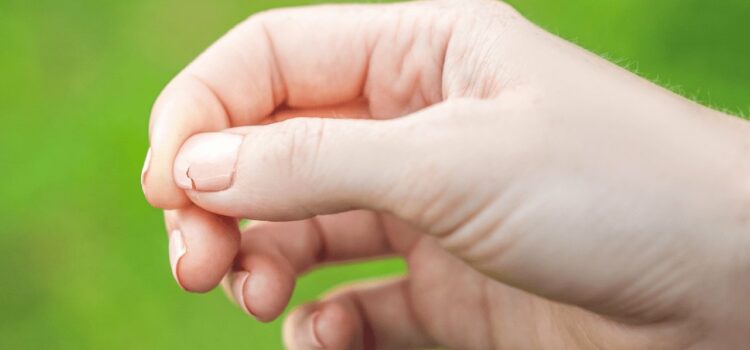 El aspecto de las uñas y lo que pueden revelar sobre tu salud